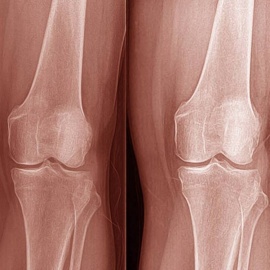 Regenerative Medicine of Central Florida